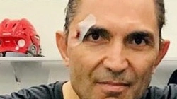 «Он просто очень высокий»: жена Хапочкина рассказала о спортивной травме супруга