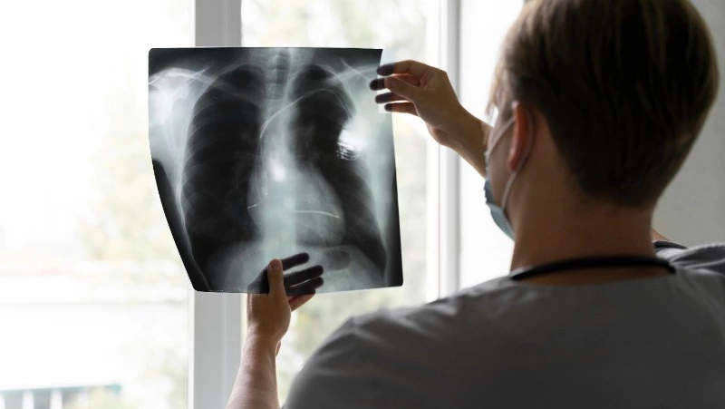 Рост заболеваемости пневмонией при невыясненных причинах фиксируют на Сахалине