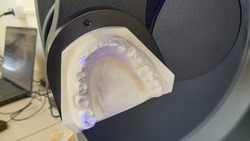 Современное оборудование для зубного протезирования появилось на Сахалине