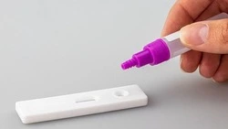 В Госдуме возмутились ценой теста на коронавирус. «Закупочная цена — 150 рублей»