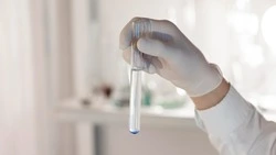 Россельхознадзор нашел нарушения в кафе в Третьей Пади после массового отравления