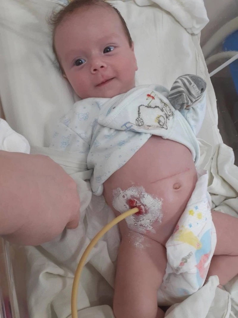 Трехмесячному сахалинцу Алексею нужна помощь для срочной операции в Москве