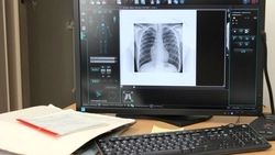 По улицам Анивы разгуливал заразный туберкулезник