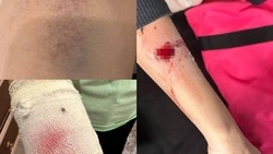 Следователи взяли под контроль ситуацию с нападением собаки на ребенка в Южно-Сахалинске