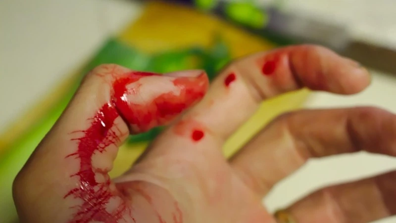 «Не менее 11 ударов»: сахалинка умерла в больнице после страшной поножовщины