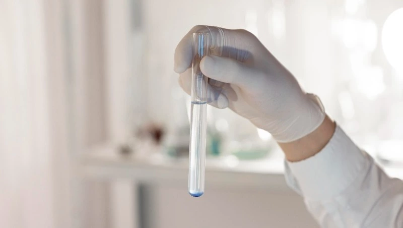 Россельхознадзор нашел нарушения в кафе в Третьей Пади после массового отравления