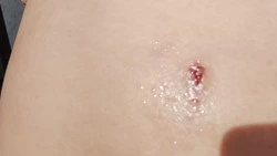 Собака набросилась на женщину с ребенком в Южно-Сахалинске