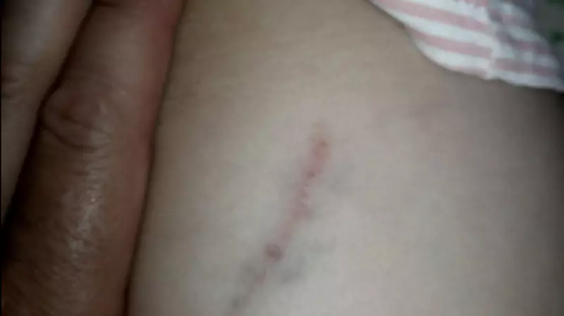 В Южно-Сахалинске бездомная собака покусала ребенка