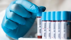 Рост заболеваемости коронавирусом зафиксировали в 4 районах Сахалина