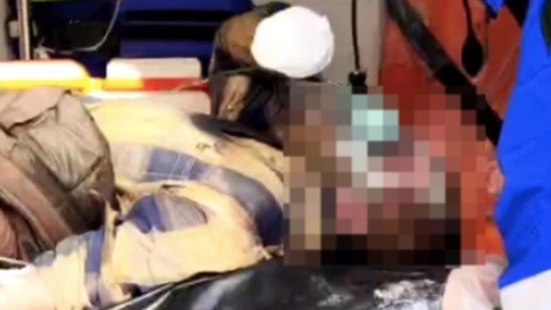 Мужчина едва не сгорел заживо в своей квартире в Долинском районе