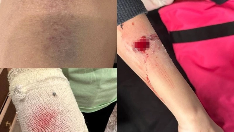 Следователи взяли под контроль ситуацию с нападением собаки на ребенка в Южно-Сахалинске