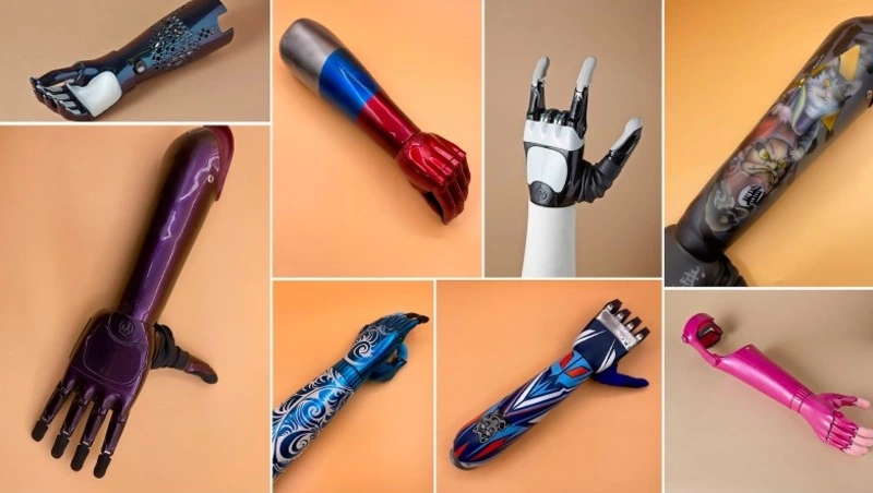 Новейшие киберпротезы рук от резидентов «Сколково» установят двоим жителям Сахалина