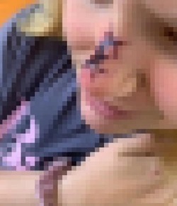 Собака разодрала лицо ребенку в Поронайском районе