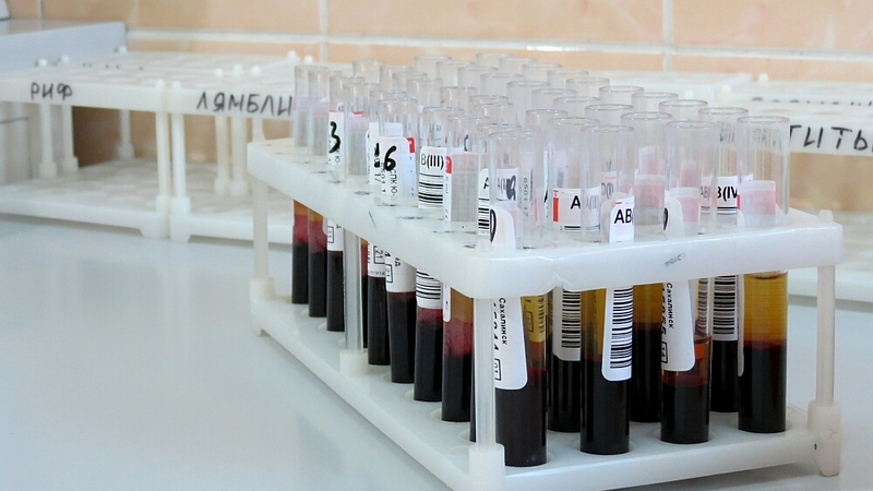 Сахалинцам предлагают бесплатно провериться на скрытые инфекции