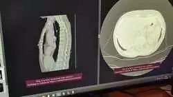 Сто снимков в день и без выходных: врачи Сахалина ставят рекорды в точной диагностике