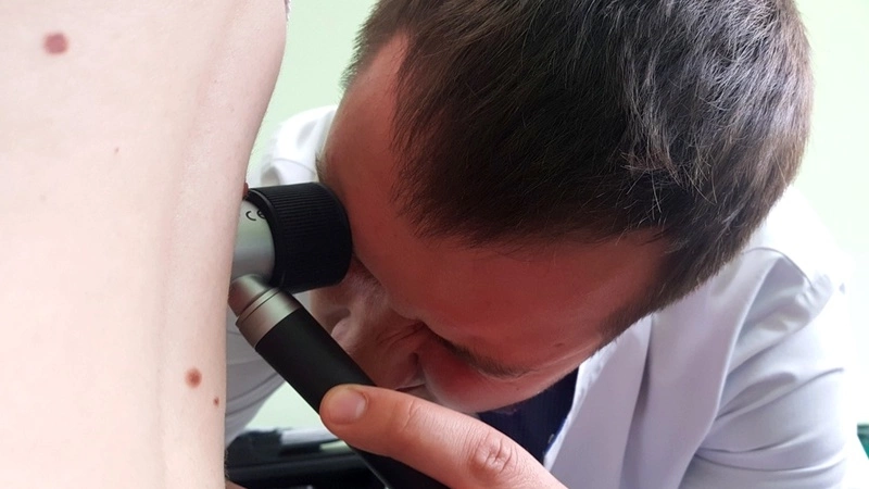 Более 300 сахалинцев решили удостовериться в безопасности родинок