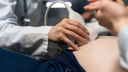 Допустимый для абортов срок беременности предложили сократить в Госдуме