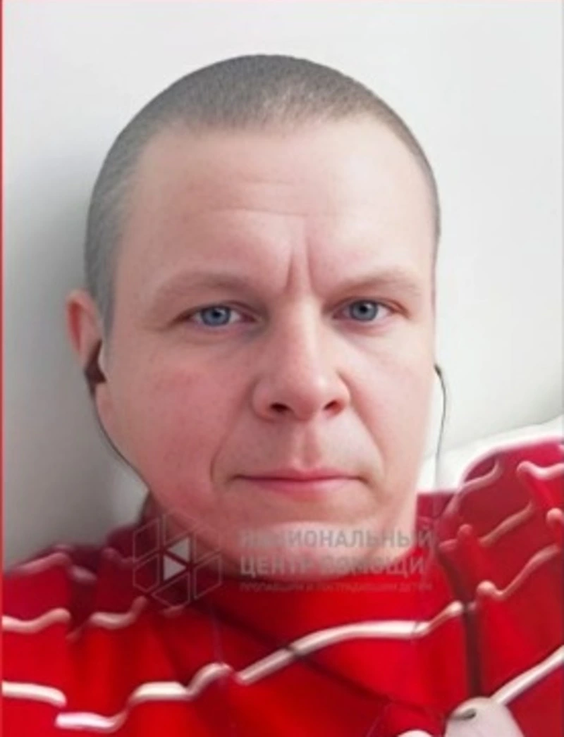 В Южно-Сахалинске пропал мужчина со шрамами на голове и лице