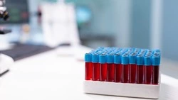 В Турции начал распространяться вирус Коксаки 