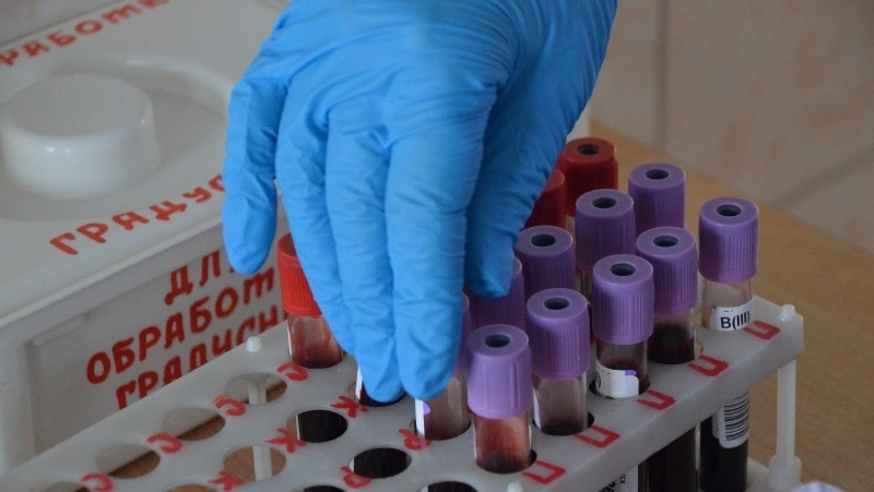 Акцию анонимной проверки на ВИЧ «Ванино — Холмск» запустят для жителей Сахалина