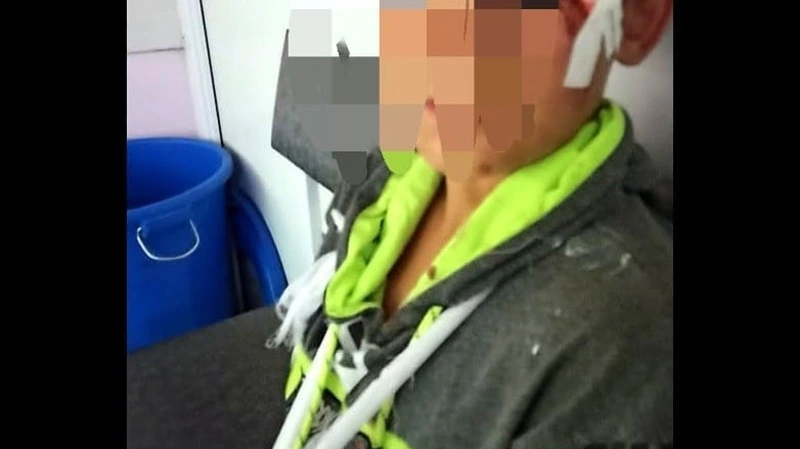 10-летний школьник пострадал в драке с подростками на Сахалине