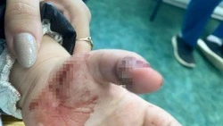 Следователи проверят обстоятельства травмирования ребенка на площадке в Шахтерске