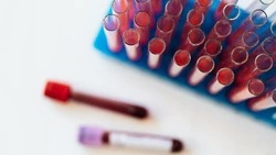 Ученые выяснили, носители какой группы крови стареют медленнее 