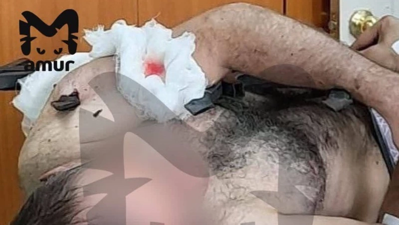 Рабочий упал на железные пики забора во время установки видеокамер в Долинске