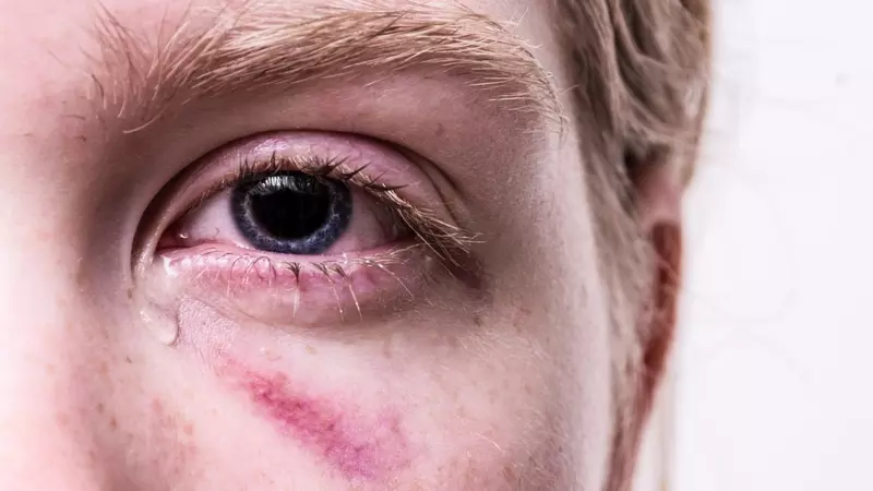 Прокуратура проводит проверку тубдиспансера, где избили 10-летнего мальчика