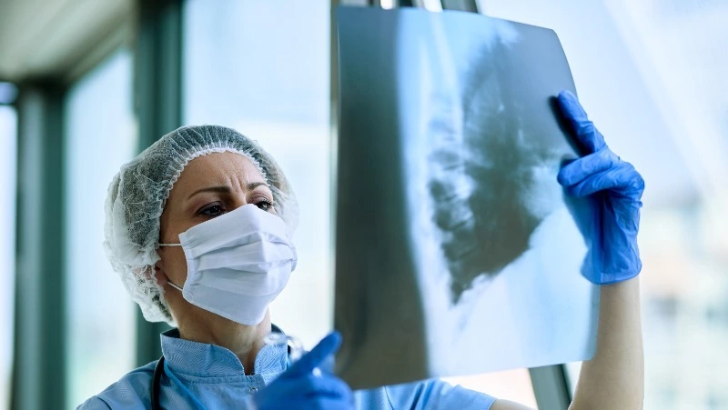 На Сахалине зафиксировали рост заболеваемости внебольничной пневмонией 