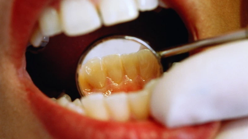 На Сахалине стоматолог с коронавирусом продолжал работать с пациентами