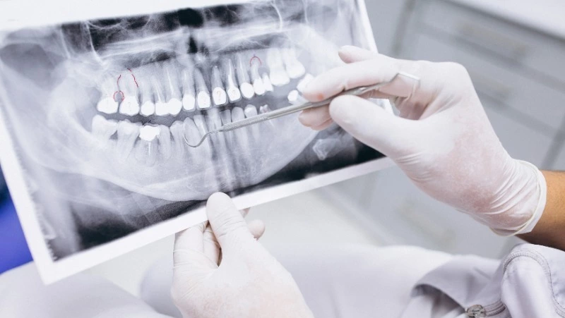 Инвалиду с ДЦП на Сахалине вылечат зубы после обращения к губернатору