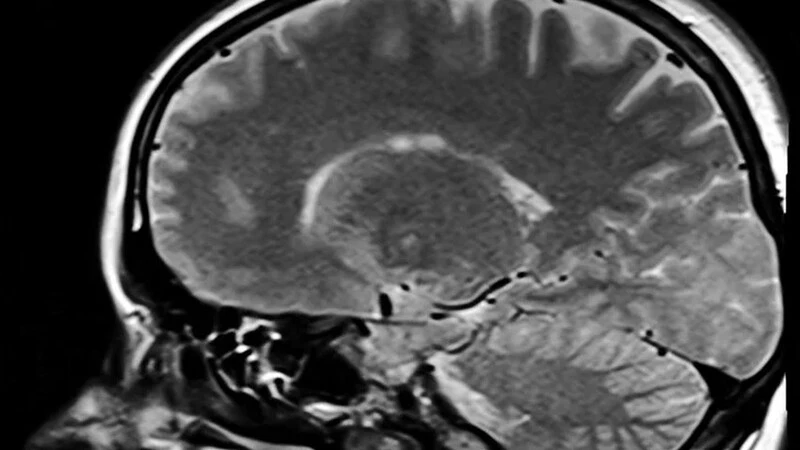 На Сахалине у первоклассника обнаружили рак мозга — объявили срочный сбор денег