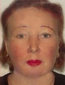 В Корсакове пропала 58-летняя лысая женщина