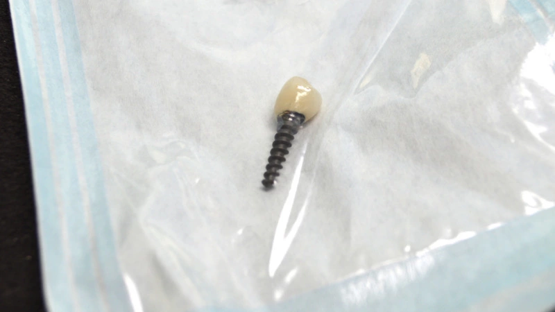 Зубы made in China