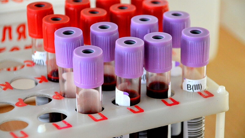 Биохимия зависимости