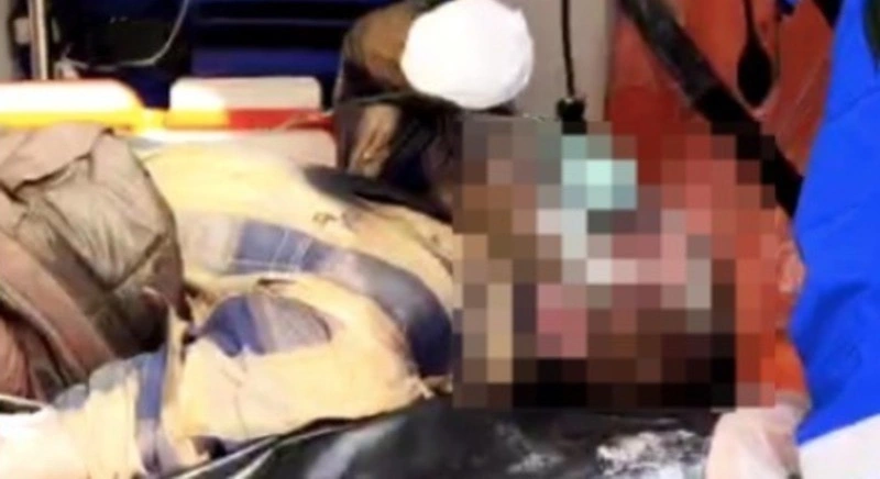 МЧС рассказало детали пожара в Углезаводске, где едва не сгорел заживо мужчина