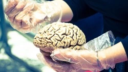 Как распознать инсульт у человека: справка для жителей Сахалина