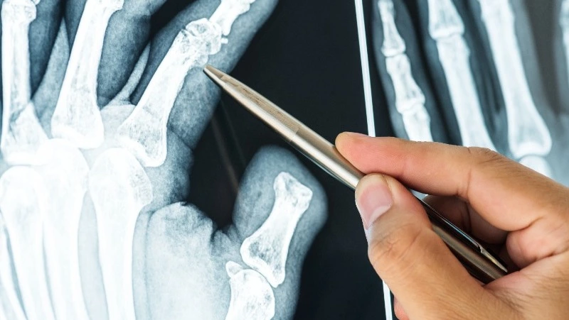 Ошибка воспитателя на Сахалине стоила детсаду 60 тысяч рублей и сломанной кости ребенку