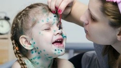 Российский терапевт опровергла популярный миф об эффективности зеленки