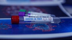 Японцы создали 30-минутный тест на коронавирус с точным результатом