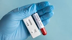 «Ковид останется с людьми навсегда»: прогноз эпидемиолога по заболеваемости COVID-19