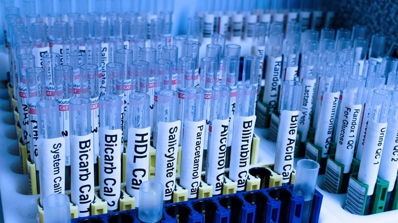 В трех рыбоводных реках на юге Сахалинской области нашли вредные бактерии