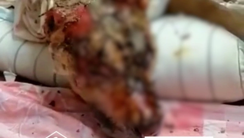  «Месяц прошел»: сахалинские волонтеры рассказали о состоянии обгоревшего пса Михея 