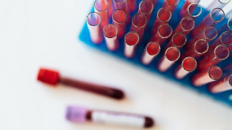 Ученые выяснили, носители какой группы крови стареют медленнее 