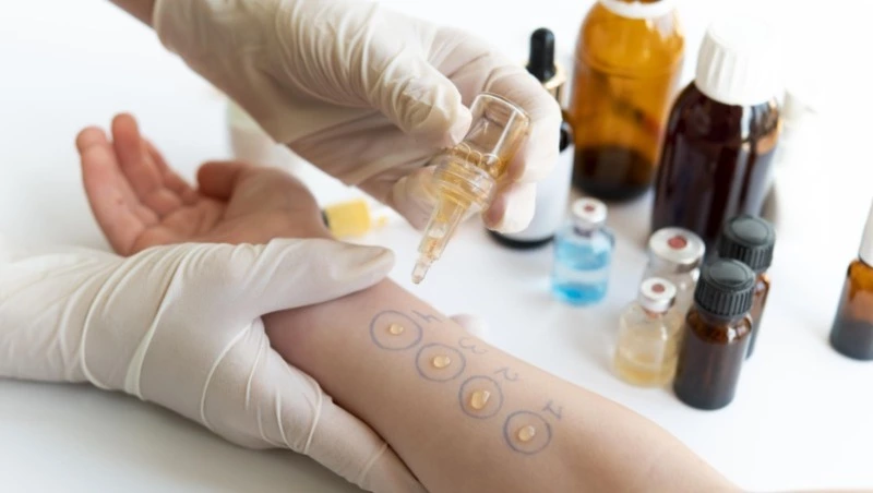 Поллиноз: что это и как с ним справиться?