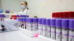 Медики за четыре минуты запустили остановившееся сердце 15-летней девочки в Кузбассе