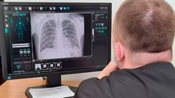 Сахалинцы стали реже умирать от туберкулеза