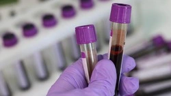 За неделю на Сахалине зарегистрировали 8 случаев заболевания корью