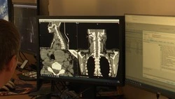 Исследование организма с помощью специального облучения. Медосмотр 19.10.23